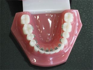 Ortho Dental Family Care dientes 1