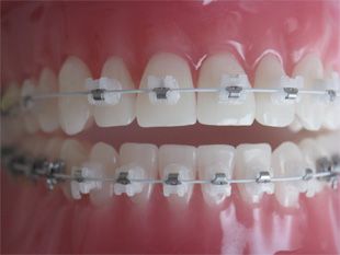 Ortho Dental Family Care dientes con ortodoncia 