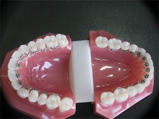 Ortho Dental Family Care dientes 2