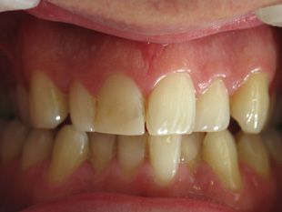 Ortho Dental Family Care dientes 4