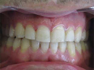Ortho Dental Family Care dientes 5